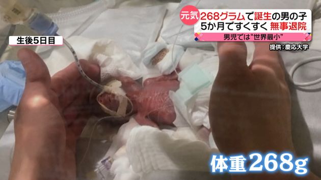 体重２６８グラムで誕生の男児 元気に退院